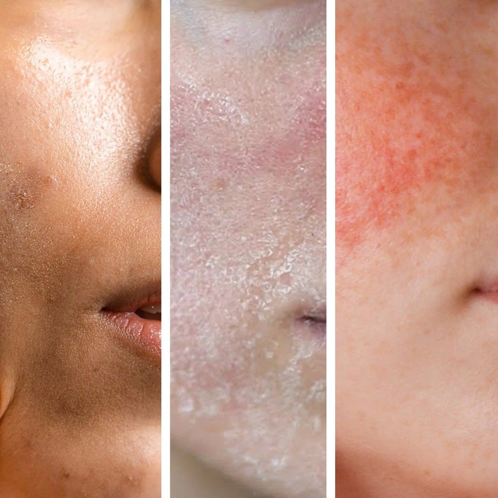 Why Hydration Remains One of the Most Important Steps in Skincare